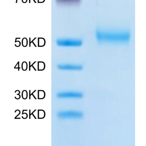 SDS-PAGE gel of Human FcRH6/FCRL6 Protein 3320