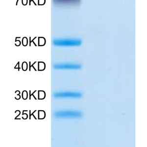 SDS-PAGE gel of Mouse CD9P1 Protein 3325