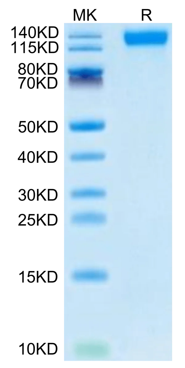 SDS-PAGE gel of SARS-COV-2 Spike S1 (Omicron B.1.1.529) Protein 3326