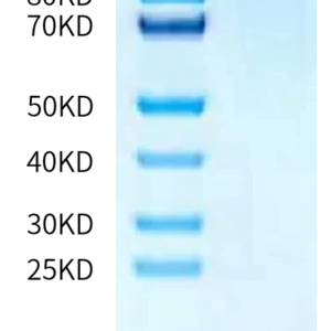 SDS-PAGE gel of Mouse CD21 Protein 3334
