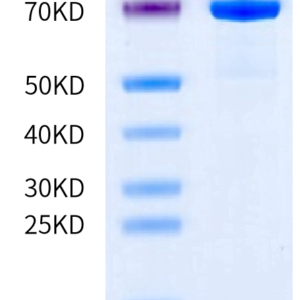 SDS-PAGE gel of Human CDH11/Cadherin 11 Protein 3344