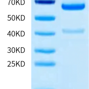 SDS-PAGE gel of Human ADAM9 Protein 3347