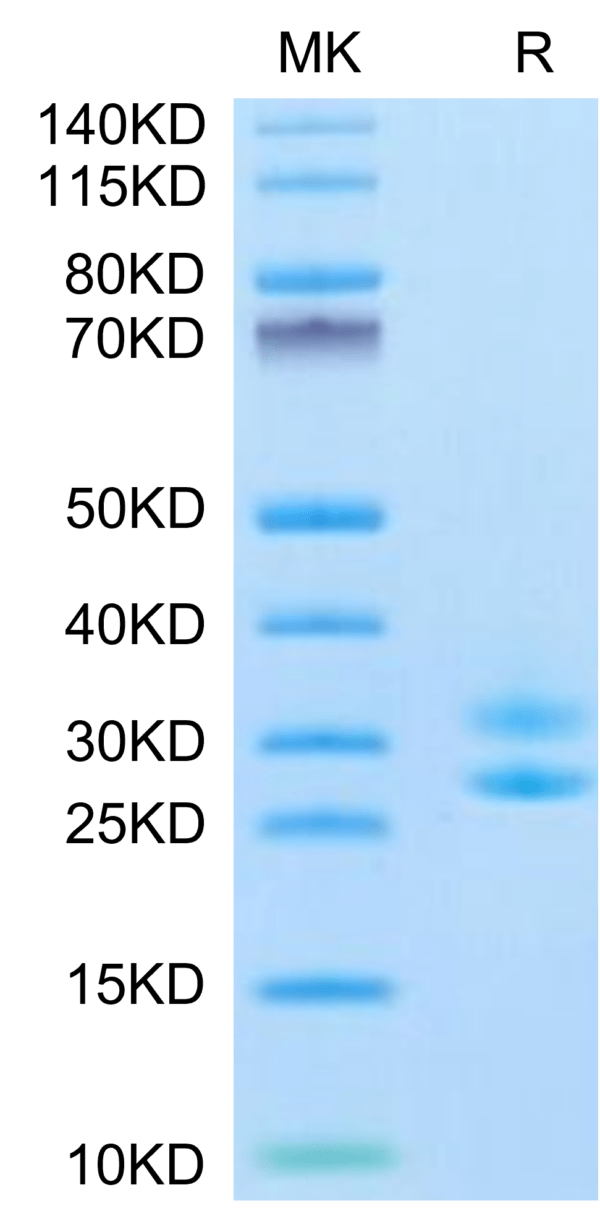 SDS-PAGE gel of Biotinylated Human IL-15RA&IL-15 Protein (Primary Amine 3366