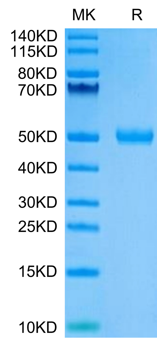 SDS-PAGE gel of Human CYTL1/C17 Protein 3368