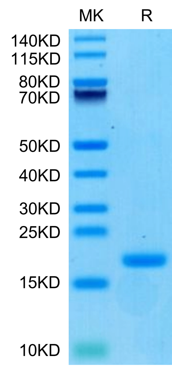 SDS-PAGE gel of Biotinylated Human ENPP-3 (48-157) Protein 3369