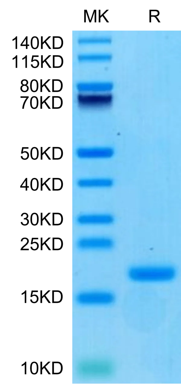 SDS-PAGE gel of Biotinylated Human ENPP-3 (48-157) Protein 3369