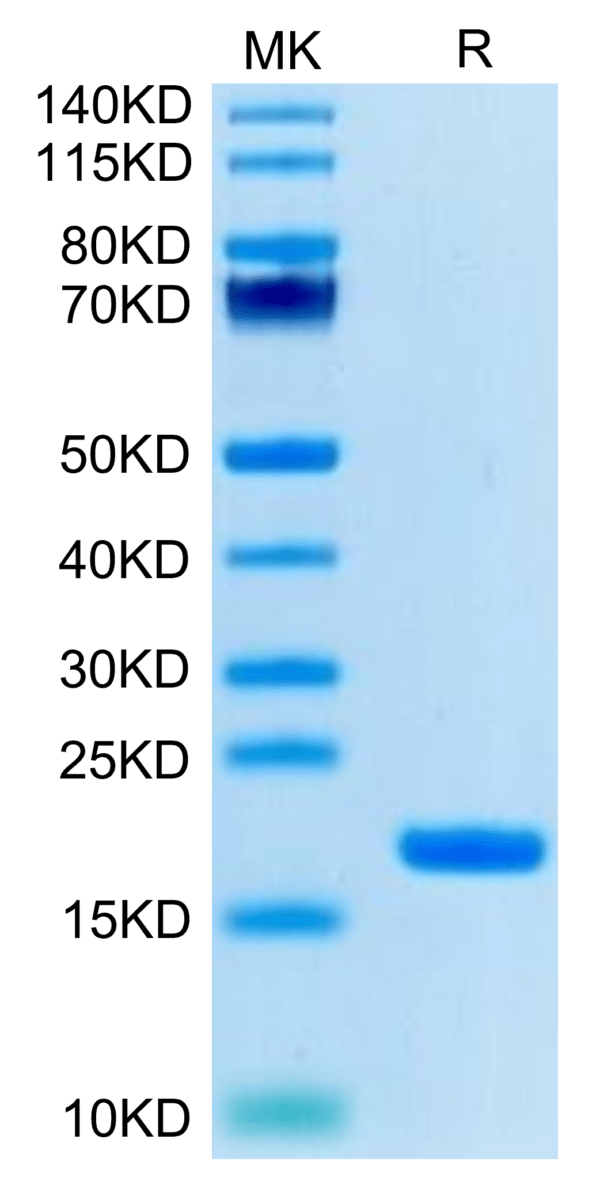 SDS-PAGE gel of Biotinylated Human IL-18 Protein (Primary Amine Labelin 3392