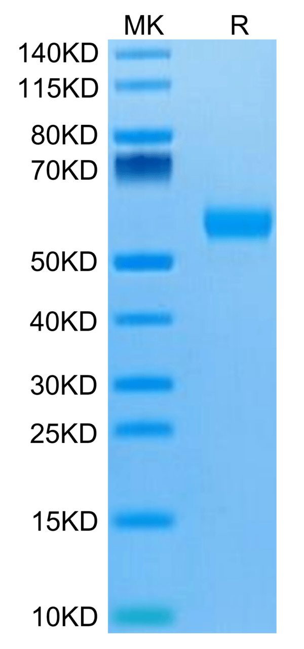 SDS-PAGE gel of Biotinylated Human IL-5 R alpha/CD125 Protein 3417