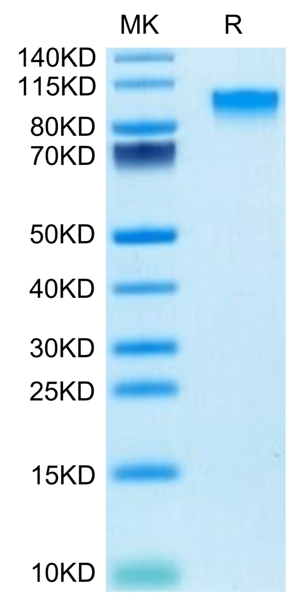 SDS-PAGE gel of Mouse IL-17R alpha/CD217 Protein 3419