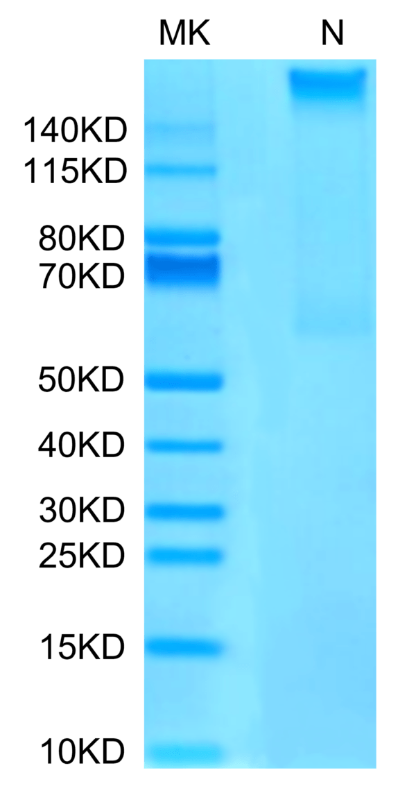 SDS-PAGE gel of Human HLA-A*02:01&B2M&MAGE-A4 (GVYDGREHTV) Tetramer Pro 3423