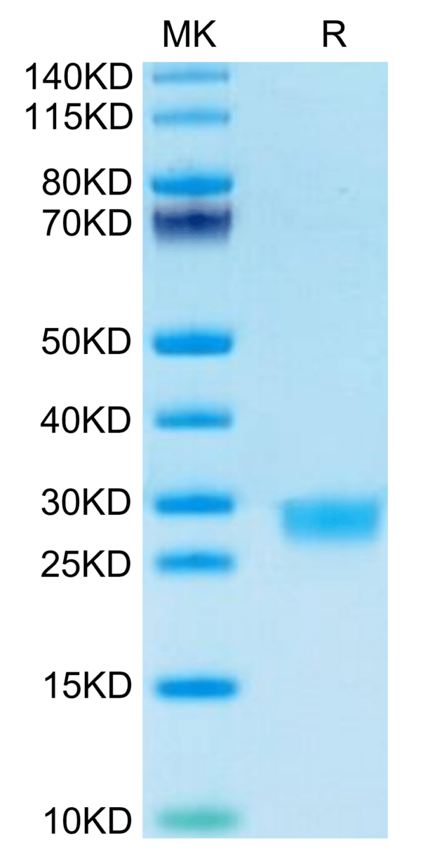 SDS-PAGE gel of Mouse IL-2 Protein 3433