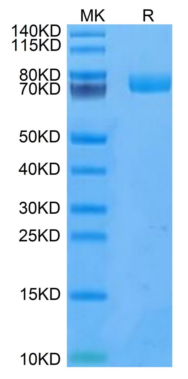 SDS-PAGE gel of Human uPAR/PLAUR Protein 3438