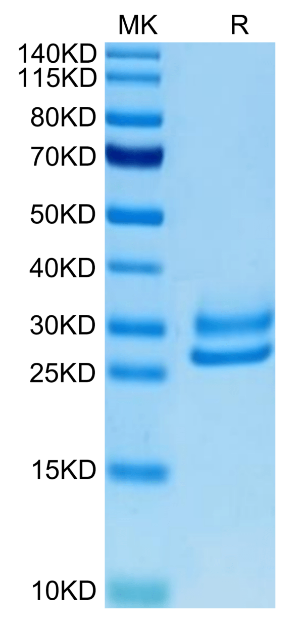 SDS-PAGE gel of Human IL-15RA&IL-15 Protein 3465