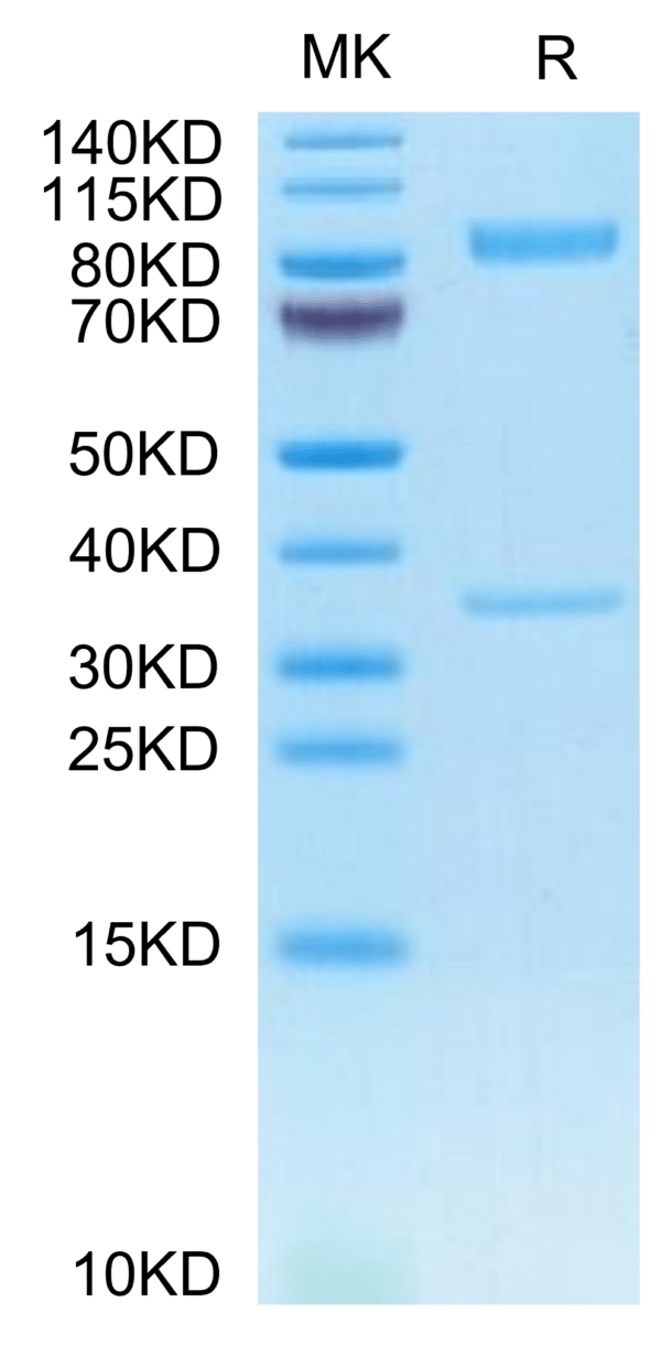 SDS-PAGE gel of Human BACE-1 Protein 3474