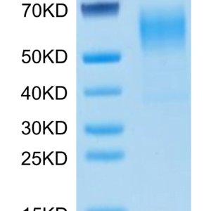 SDS-PAGE gel of Mouse CD19 Protein 3479