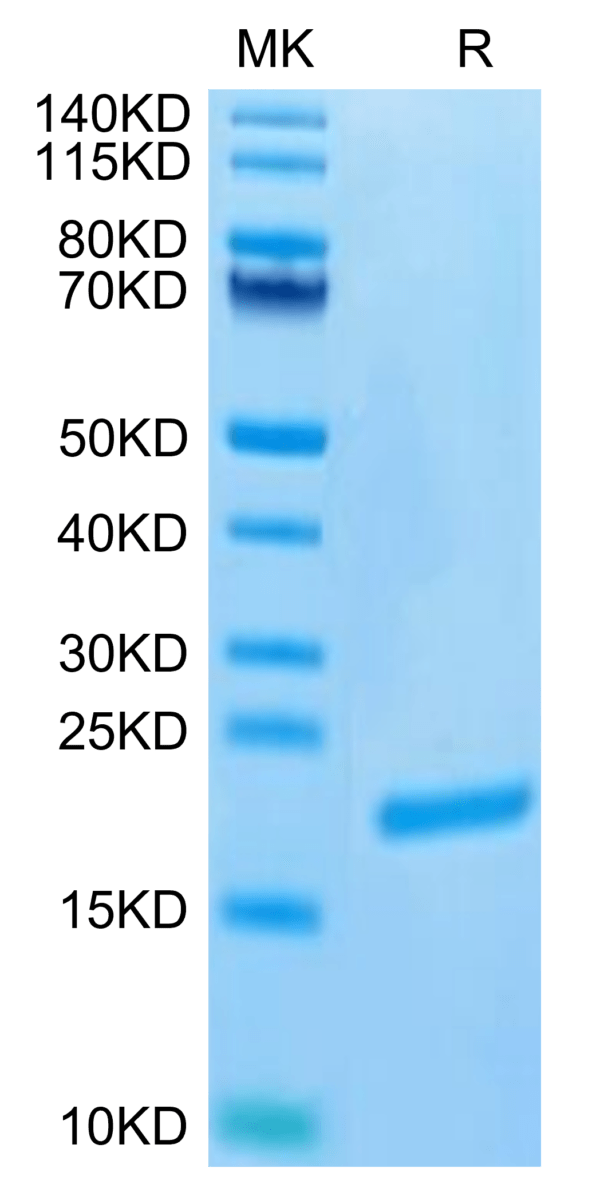 SDS-PAGE gel of Biotinylated Human FGF-7/KGF Protein (Primary Amine Lab 3480