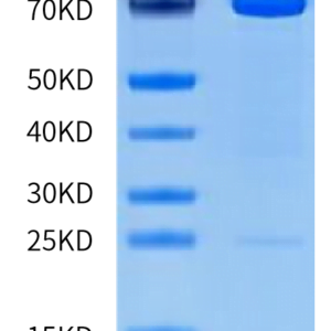 SDS-PAGE gel of Human MMP-2 Protein (pro form)  3489