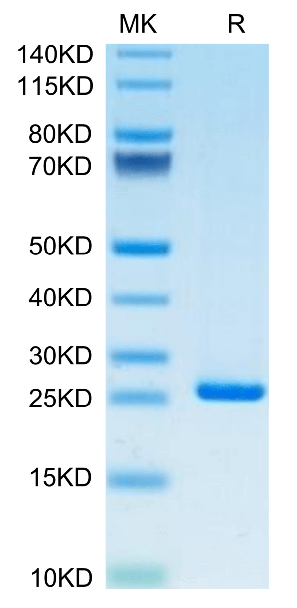 SDS-PAGE gel of Human C-Reactive Protein /CRP Protein 3552