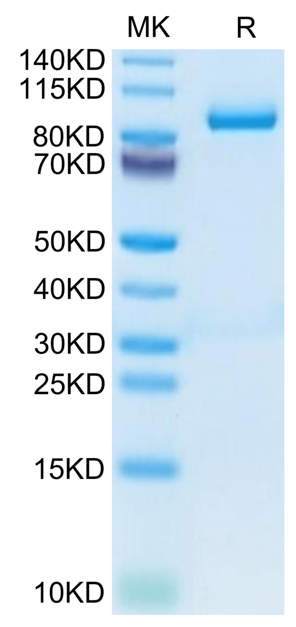 SDS-PAGE gel of Mouse Periostin/OSF-2 Protein 3557