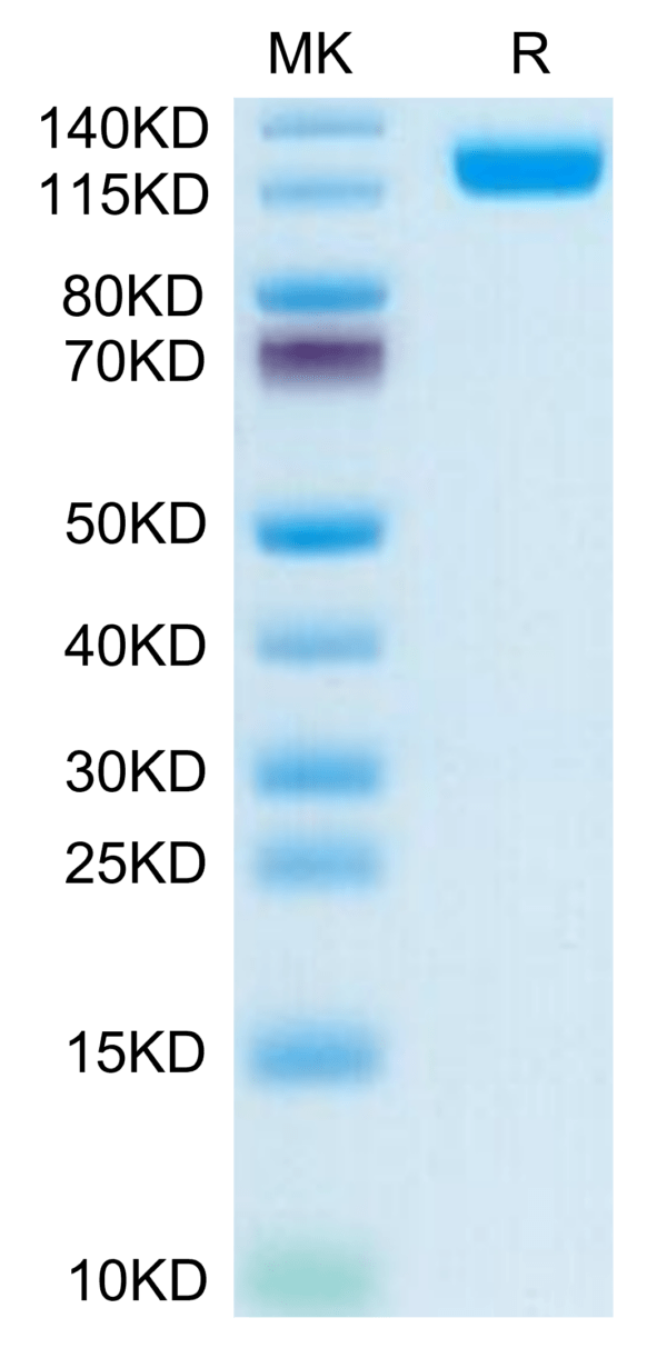 SDS-PAGE gel of Human CD13/ANPEP Protein 3565