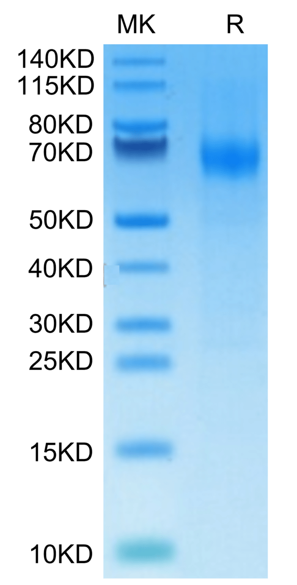 SDS-PAGE gel of Mouse IFN alpha/beta R1 Protein 3572