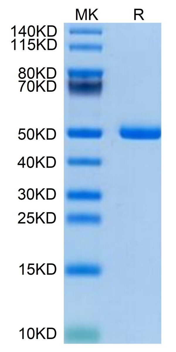 SDS-PAGE gel of Mouse PSMP Protein 3578