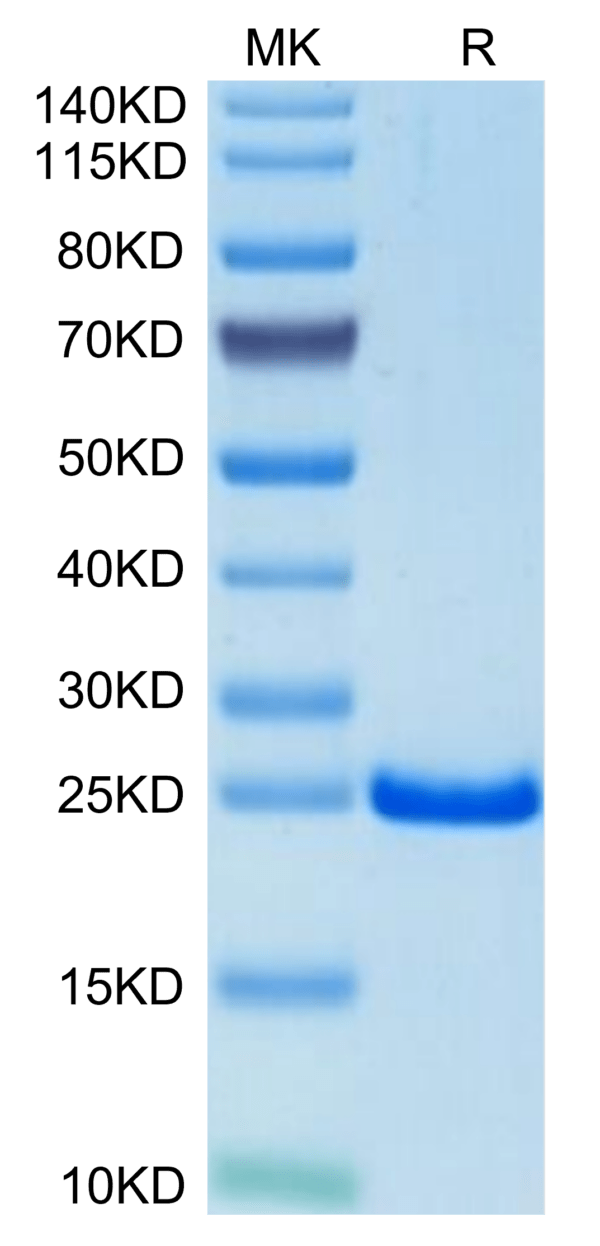 SDS-PAGE gel of Mouse TIMP-2 Protein 3583