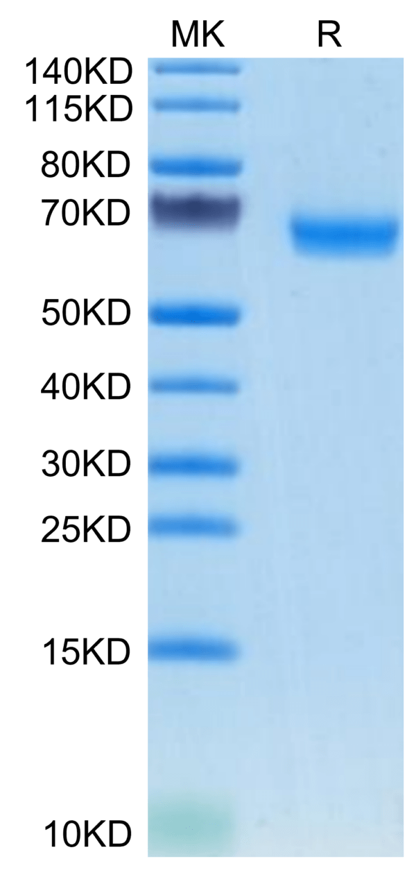 SDS-PAGE gel of Mouse TMEM106B Protein 3585