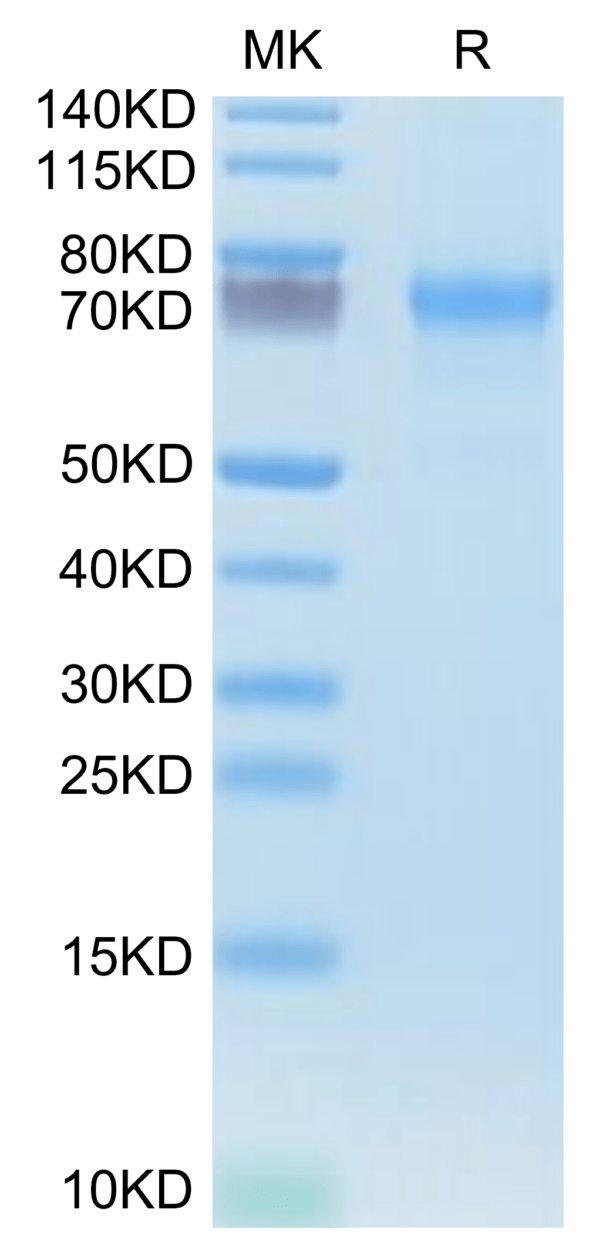 SDS-PAGE gel of Human CXCL16 Protein 3593