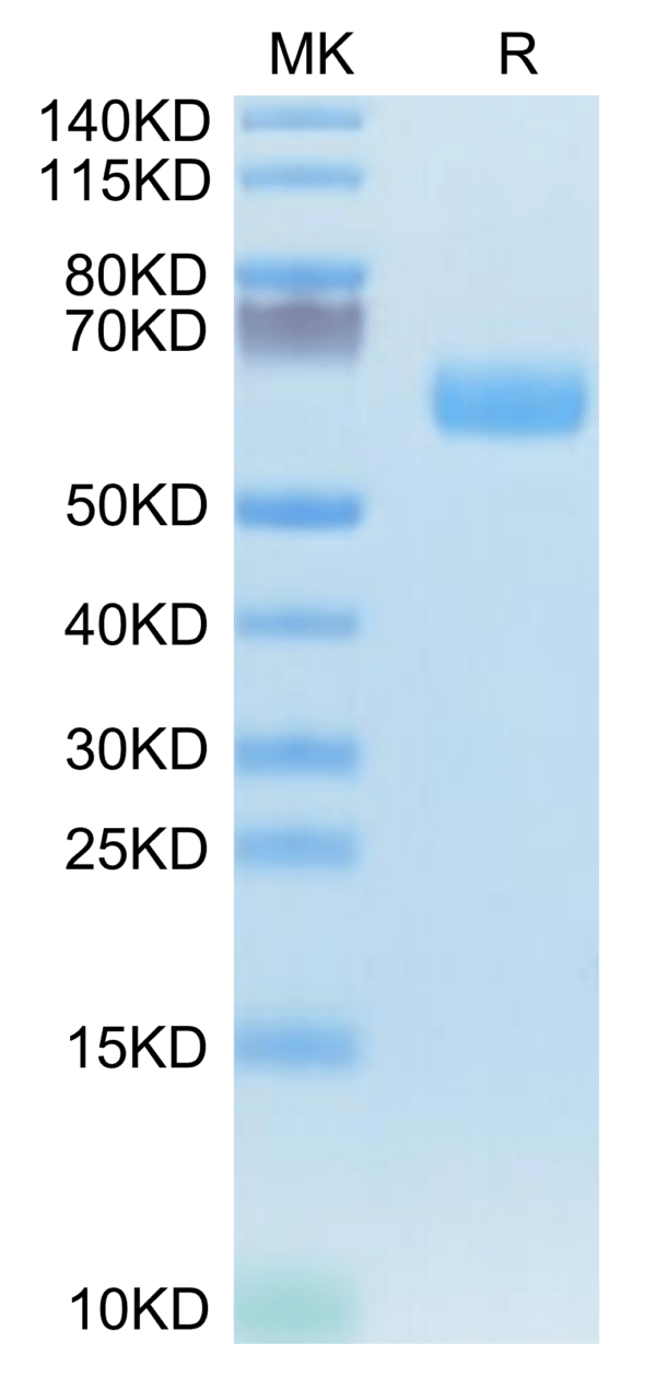 SDS-PAGE gel of Mouse WISP1 Protein 3606