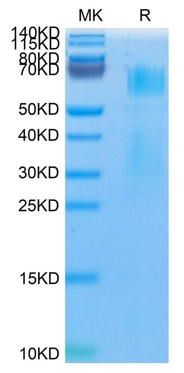 SDS-PAGE gel of Mouse MMP-8 Protein (pro form)  3608