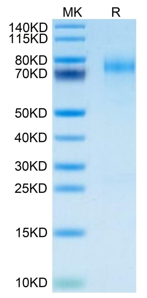 SDS-PAGE gel of Mouse LYPD3 Protein 3624