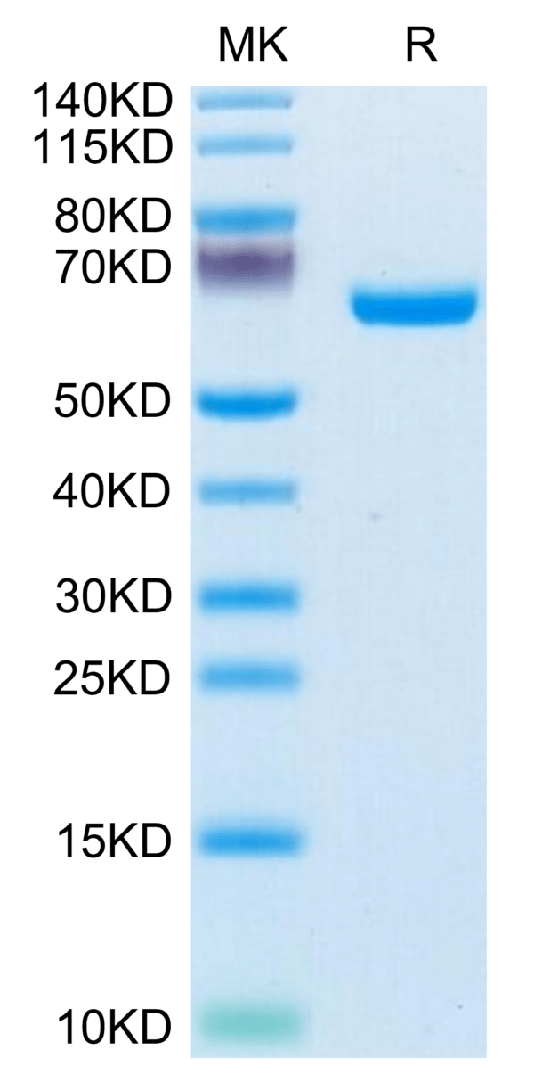 SDS-PAGE gel of Human EphB3 Protein 3626