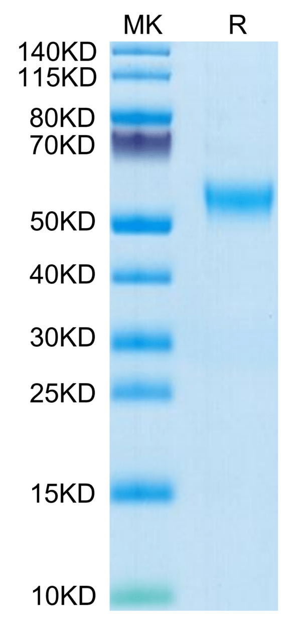 SDS-PAGE gel of Human VSTM5 Protein 3632