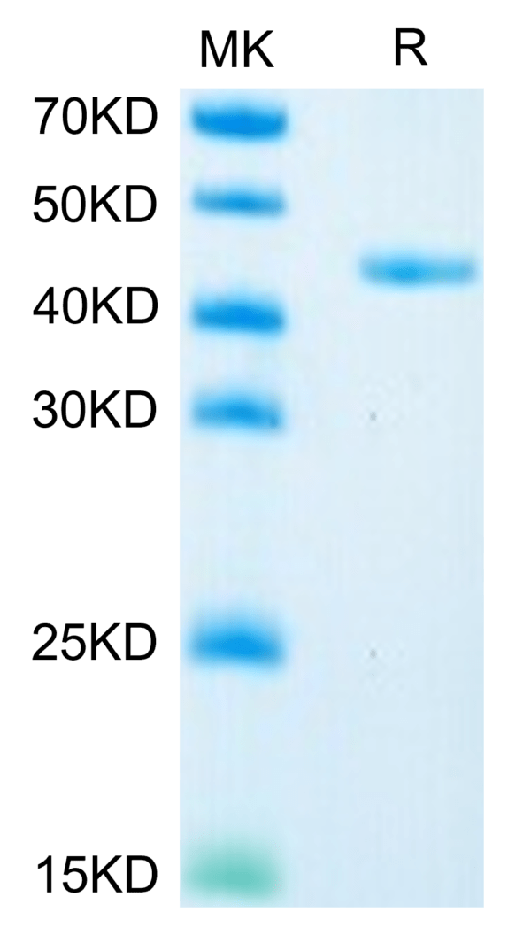 SDS-PAGE gel of Mouse Glypican 2/GPC2 Protein 3637