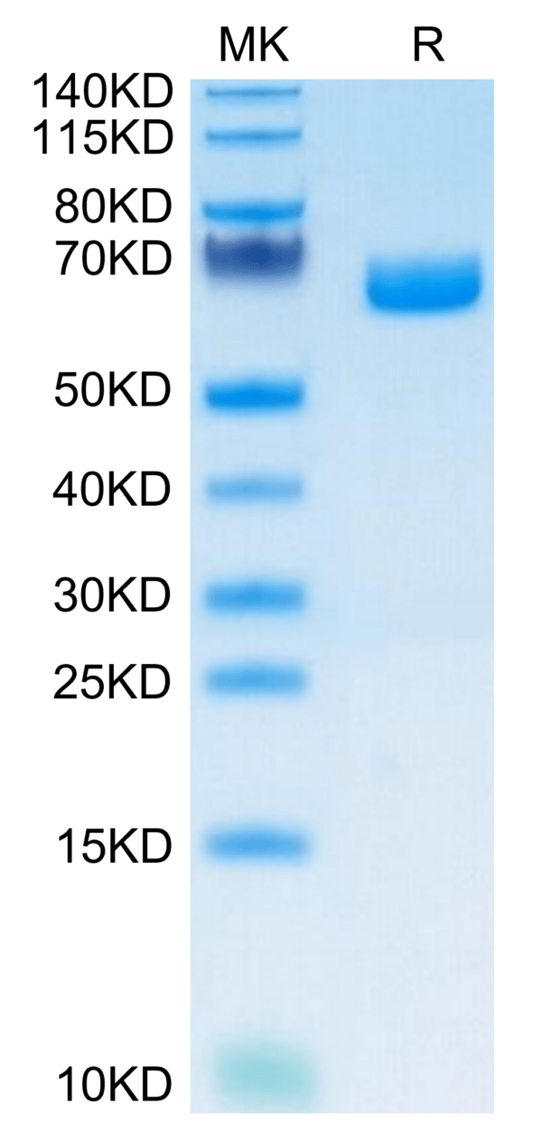 SDS-PAGE gel of Mouse IL-22R alpha 1 Protein 3641