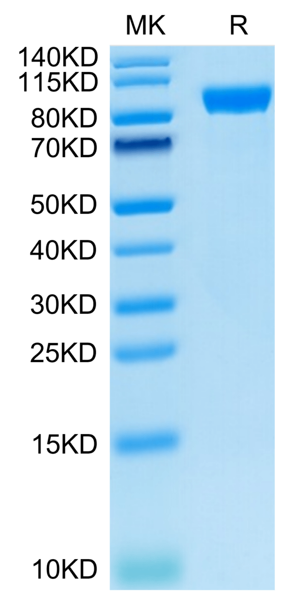 SDS-PAGE gel of Human AXL Protein 3643