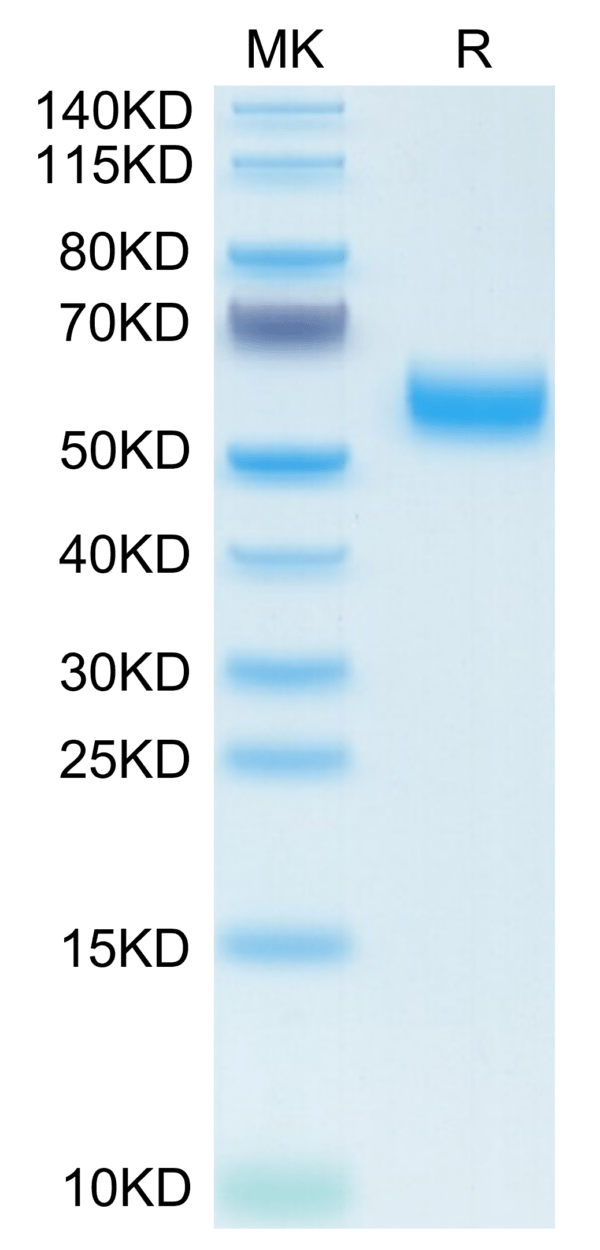 SDS-PAGE gel of Mouse VSTM5 Protein 3648