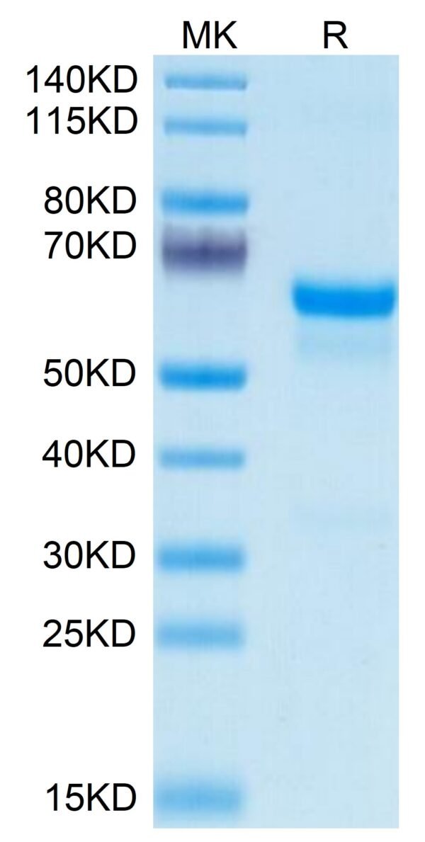 SDS-PAGE gel of Mouse PRNP Protein 3650