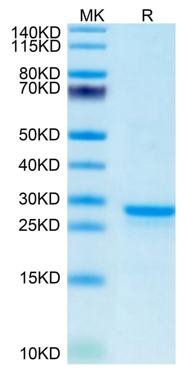 SDS-PAGE gel of Mouse PS20 Protein 3652