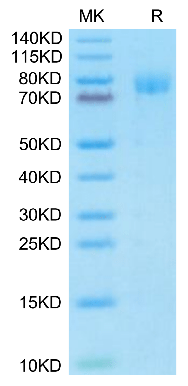 SDS-PAGE gel of Mouse MUC18/CD146 Protein 3655