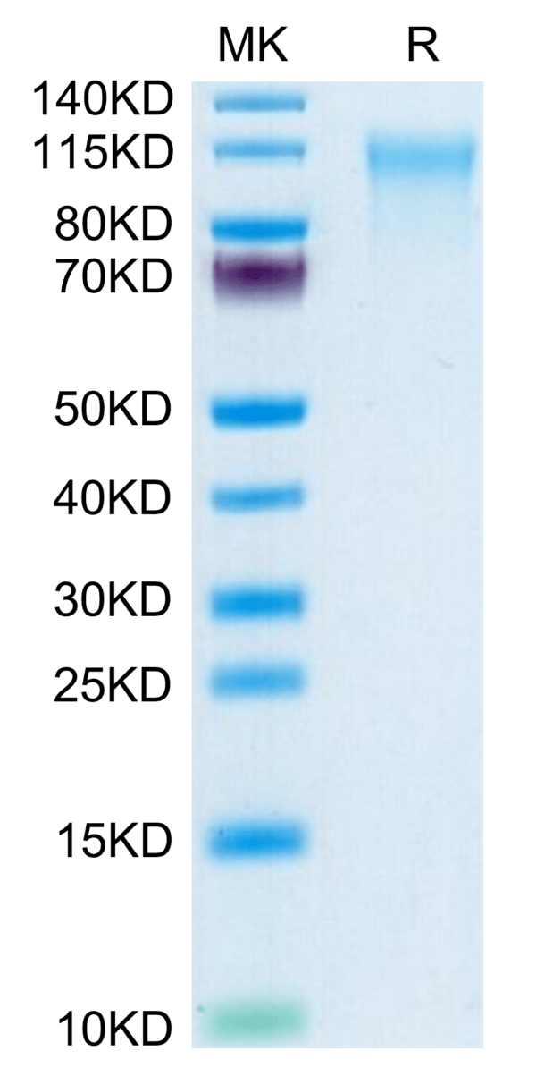 SDS-PAGE gel of Human CD164 Protein 3659