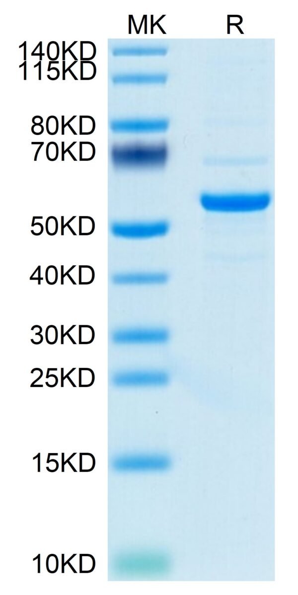 SDS-PAGE gel of Mouse Pentraxin 2/SAP Protein 3660