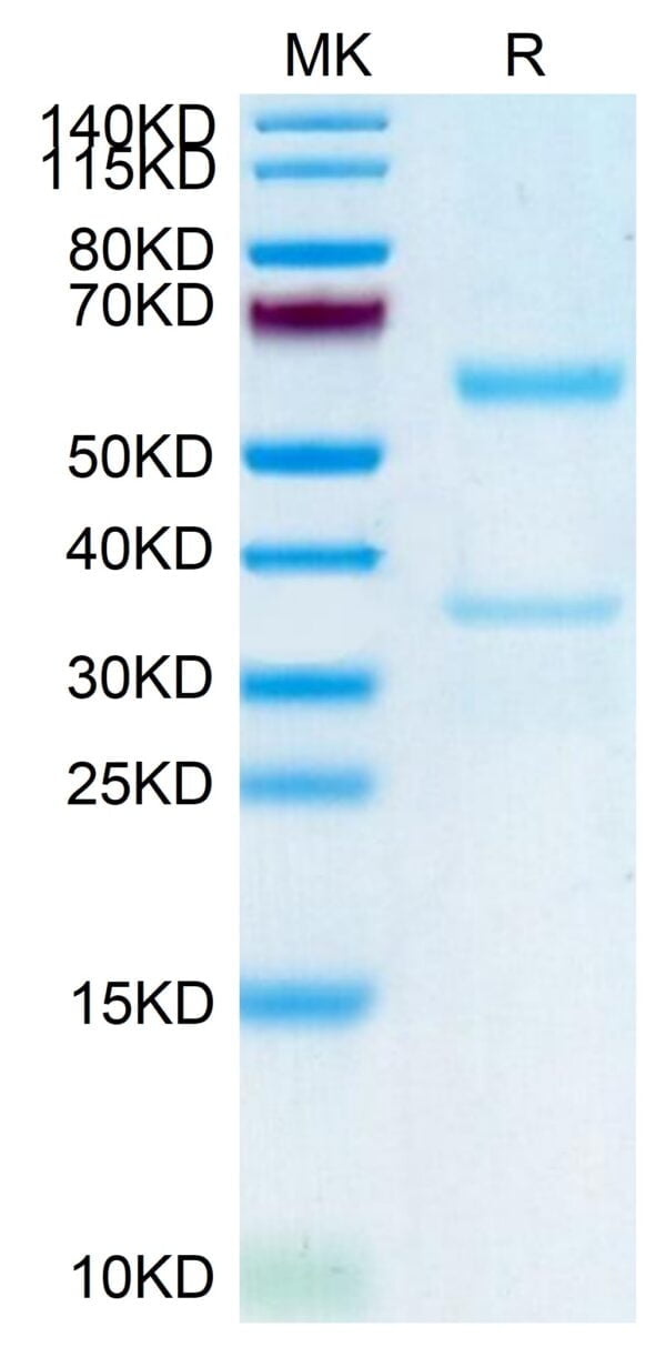 SDS-PAGE gel of Human MFAP5 Protein 3669