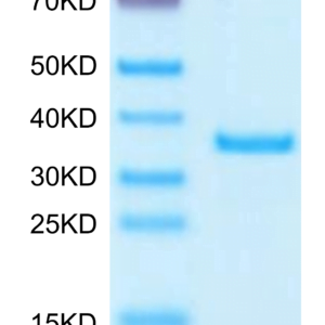 SDS-PAGE gel of Human SFRP2 Protein 3711
