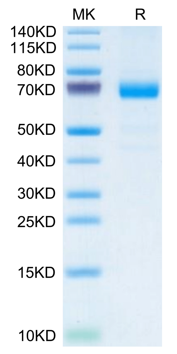 SDS-PAGE gel of Mouse IL-20RA Protein 3729