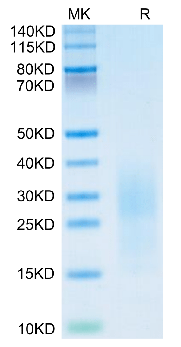 SDS-PAGE gel of Mouse PSCA Protein 3751