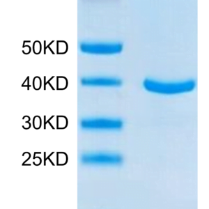 SDS-PAGE gel of Human ANXA1 Protein 3766