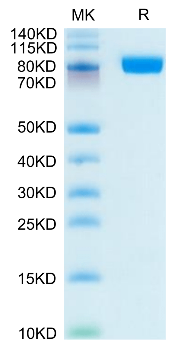 SDS-PAGE gel of Human CD10/MME Protein 3770