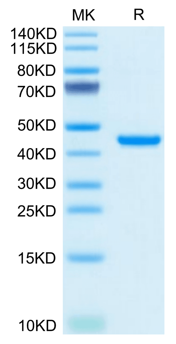 SDS-PAGE gel of Mouse RETN Protein 3785